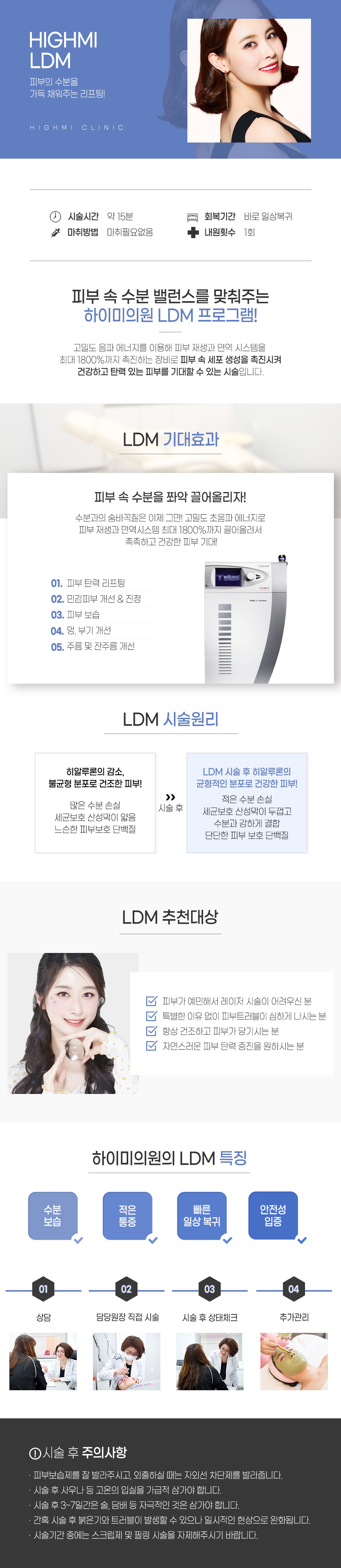 LDM