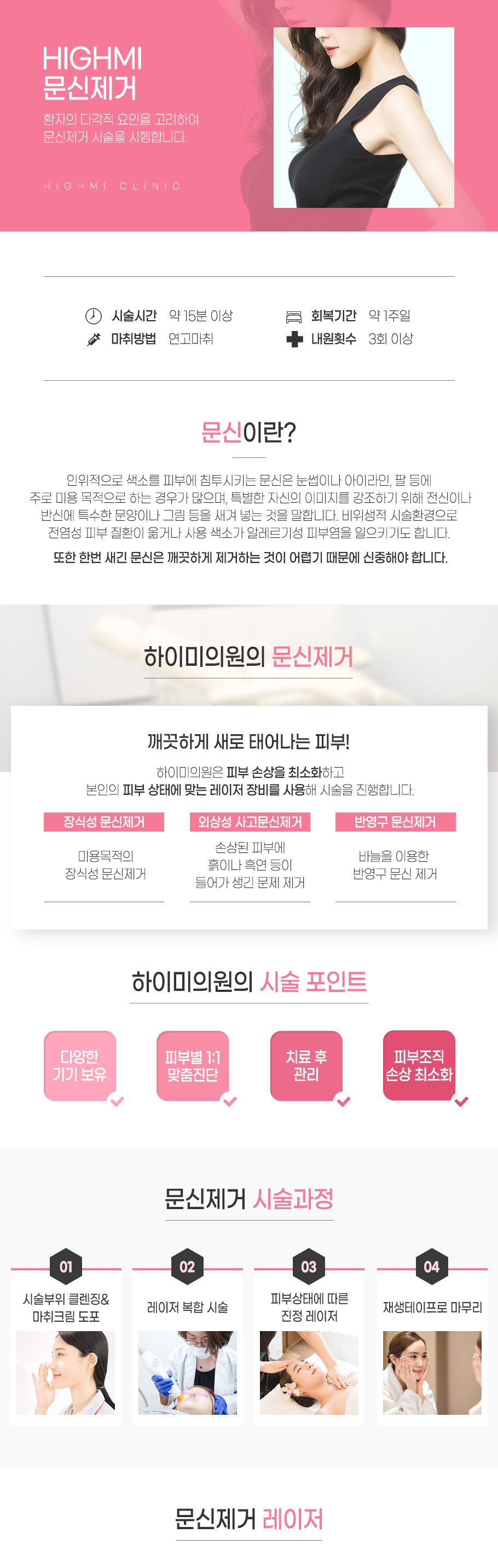 문신제거