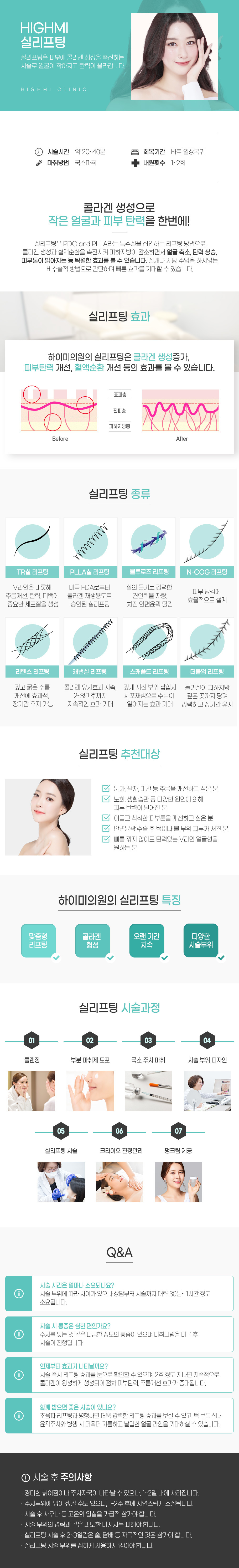 실리프팅